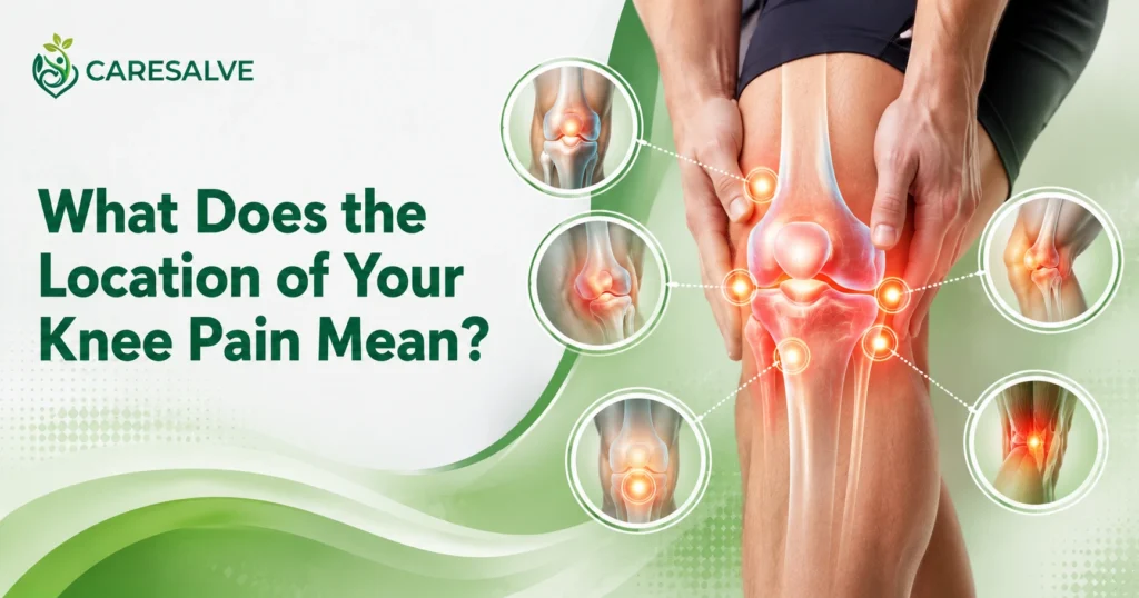 What Does the Location of Your Knee Pain Mean?
