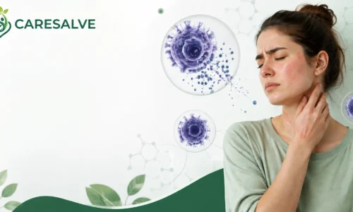 What Is Mast Cell Activation Syndrome (MCAS)? Symptoms, Causes, Diagnosis and Treatment